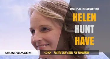 Helen Hunt's Plastic Surgery: Unveiling the Truth Behind Her Transformation