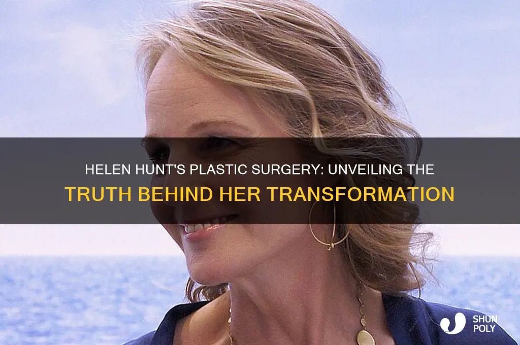 Helen Hunt's Plastic Surgery: Unveiling The Truth Behind Her ...