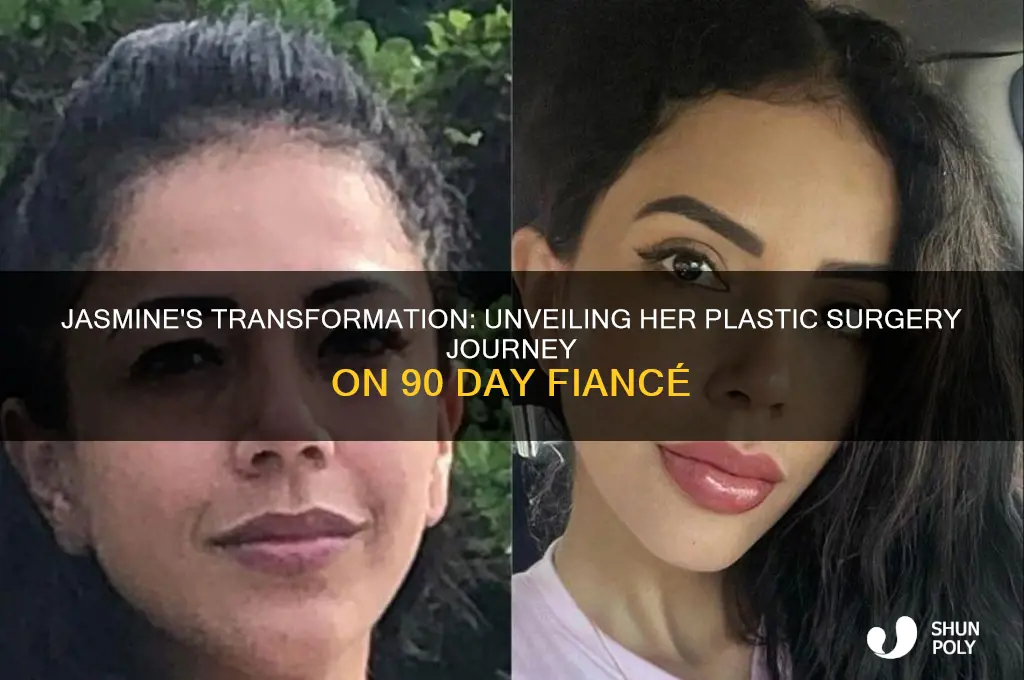 what plastic surgery did jasmine from 90 day fiance have