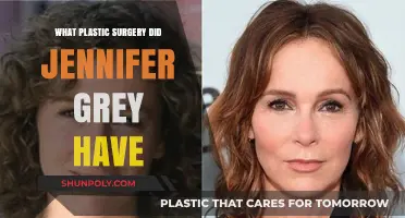 Jennifer Grey's Plastic Surgery: Unveiling Her Transformative Rhinoplasty Journey