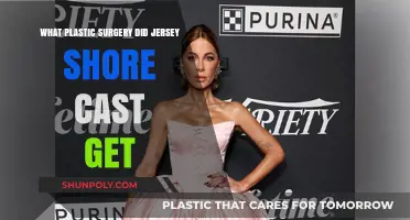 Jersey Shore Cast Plastic Surgery: Who Got What Done?