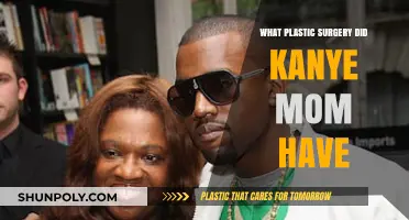 Unveiling Donda West's Plastic Surgery Journey: Kanye's Mom's Transformation