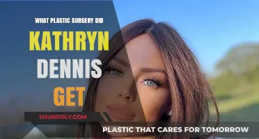 Kathryn Dennis Plastic Surgery: Unveiling Her Transformation Journey