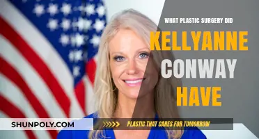 Kellyanne Conway's Plastic Surgery: Unveiling Her Transformation Journey