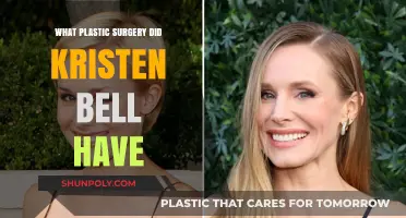 Kristen Bell's Plastic Surgery: Rumors, Facts, and Her Candid Perspective