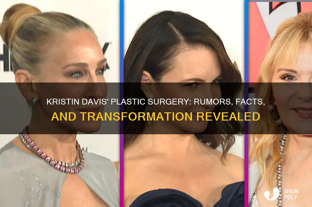 what plastic surgery did kristin davis have