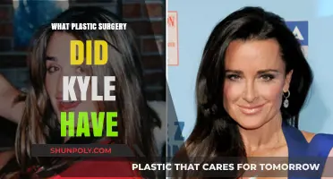 Kyle Richards' Plastic Surgery: Procedures, Results, and Transformation Explained