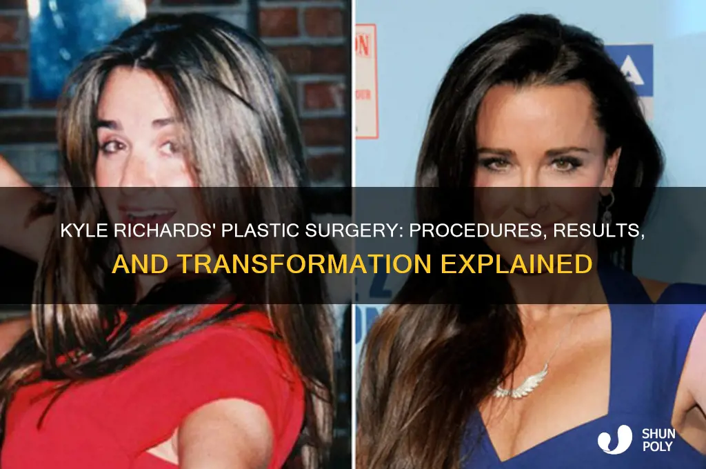 what plastic surgery did kyle have