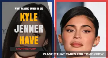 Unveiling Kylie Jenner's Plastic Surgery Transformations: What Procedures Did She Undergo?