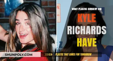 Kyle Richards' Plastic Surgery Journey: Procedures and Transformations Revealed