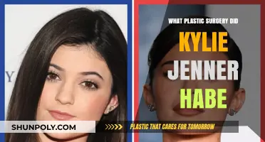 Kylie Jenner's Plastic Surgery Journey: Procedures and Transformations Revealed