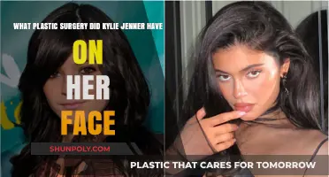 Kylie Jenner's Facial Transformation: Uncovering Her Plastic Surgery Secrets