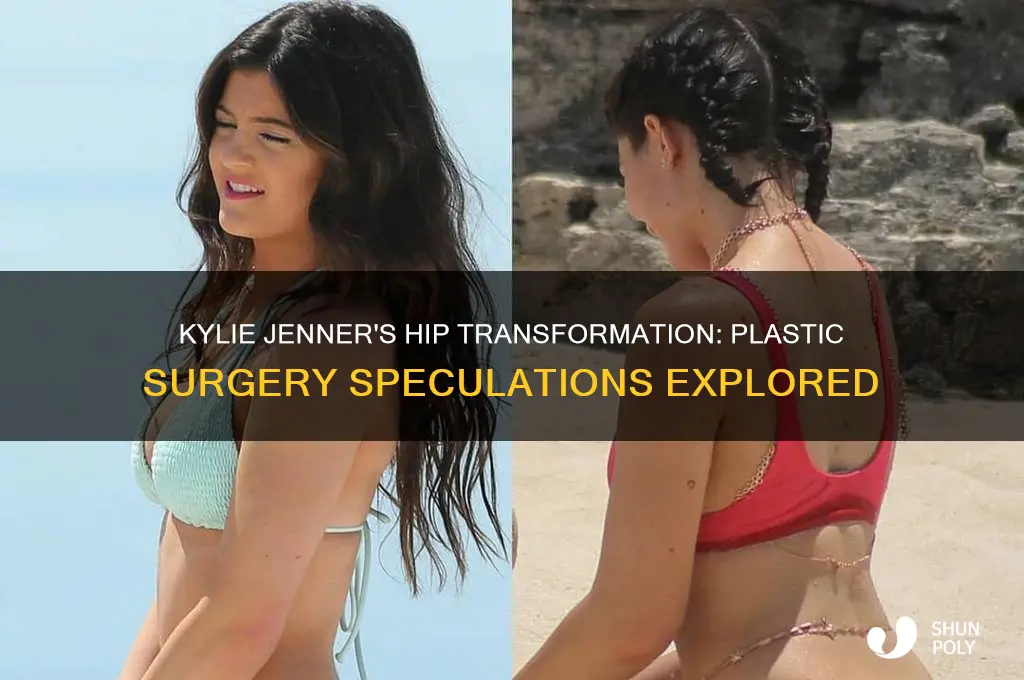 what plastic surgery did kylie jenner have on her hips