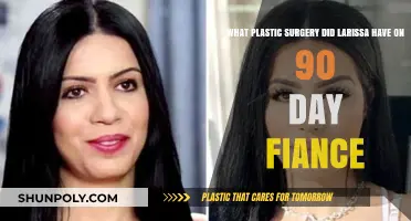 Larissa's Plastic Surgery Journey on 90 Day Fiancé: What She Had Done