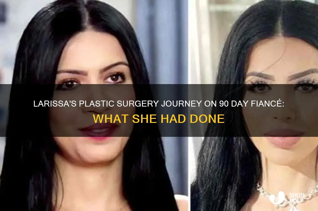 what plastic surgery did larissa have on 90 day fiance