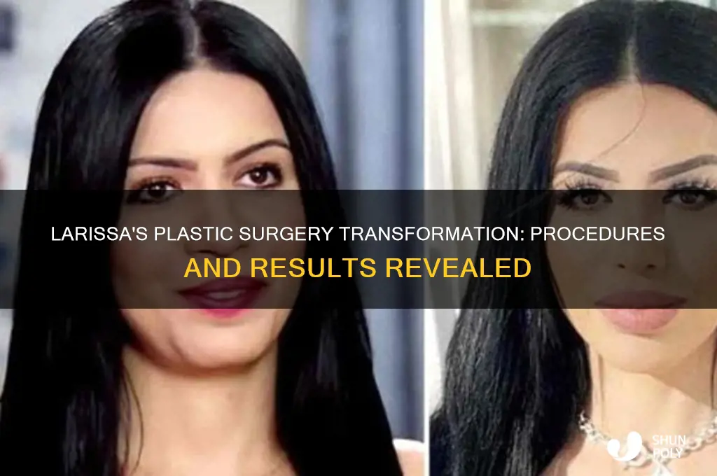 what plastic surgery did larissa have