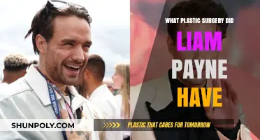 Liam Payne's Plastic Surgery: Unveiling the Truth Behind His Transformation