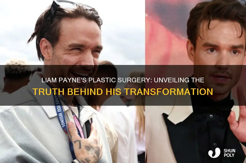 what plastic surgery did liam payne have