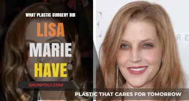 Lisa Marie Presley's Plastic Surgery: Unveiling Her Transformation Journey