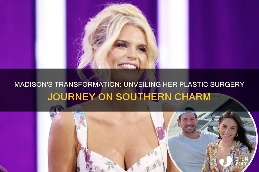what plastic surgery did madison from southern charm have