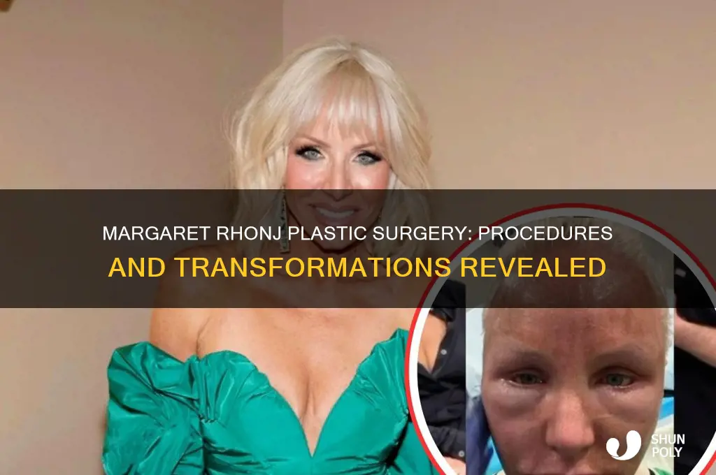 what plastic surgery did margaret from rhonj have