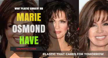 Marie Osmond's Plastic Surgery Journey: Procedures and Transformations Revealed