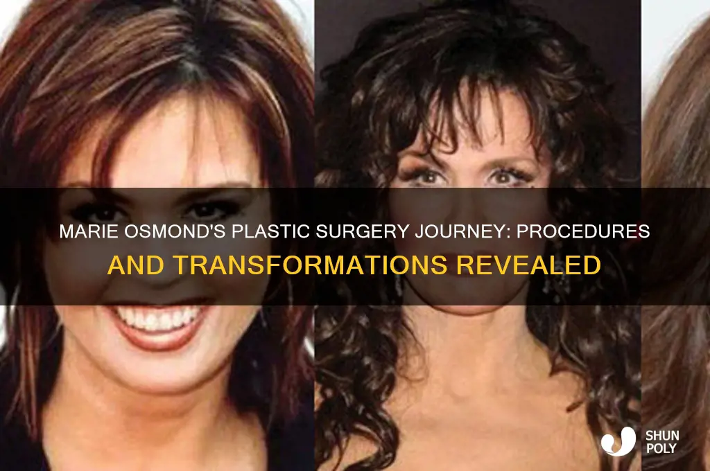 what plastic surgery did marie osmond have