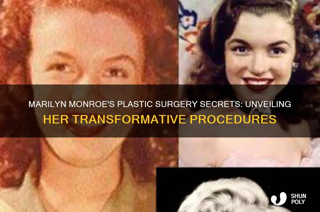 what plastic surgery did marilyn monroe get