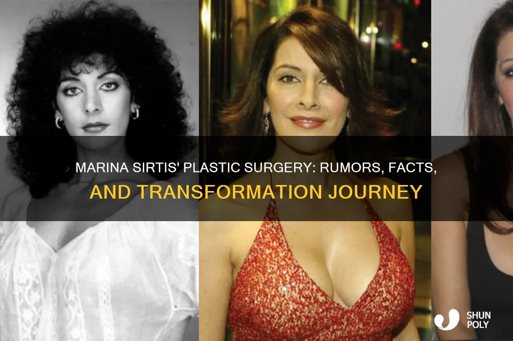 what plastic surgery did marina sirtis