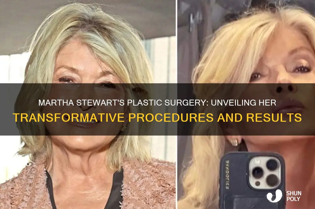what plastic surgery did martha stewart have