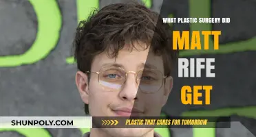 Matt Rife's Plastic Surgery: Unveiling His Transformative Procedures and Results