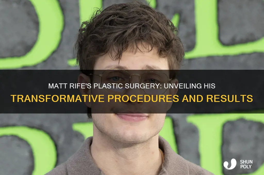 what plastic surgery did matt rife get