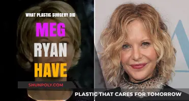 Meg Ryan's Plastic Surgery: Unveiling the Truth Behind Her Transformation