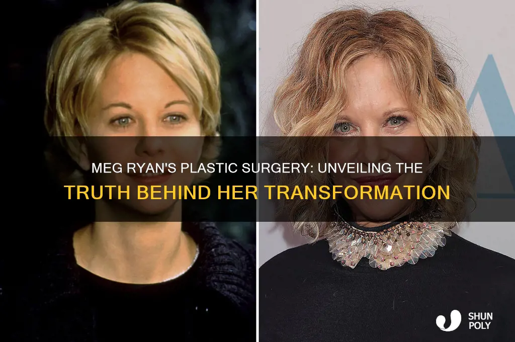 what plastic surgery did meg ryan have