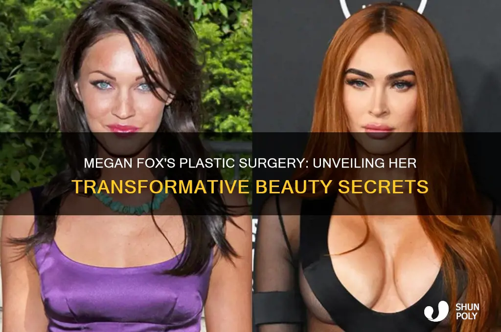 what plastic surgery did megan fox get