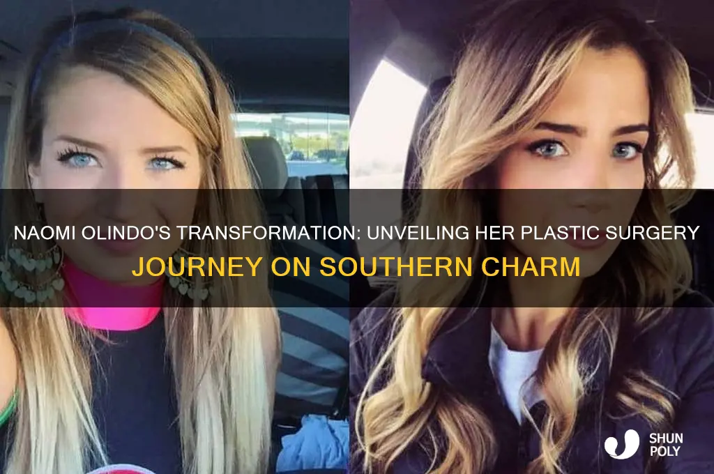 what plastic surgery did naomi from southern charm have