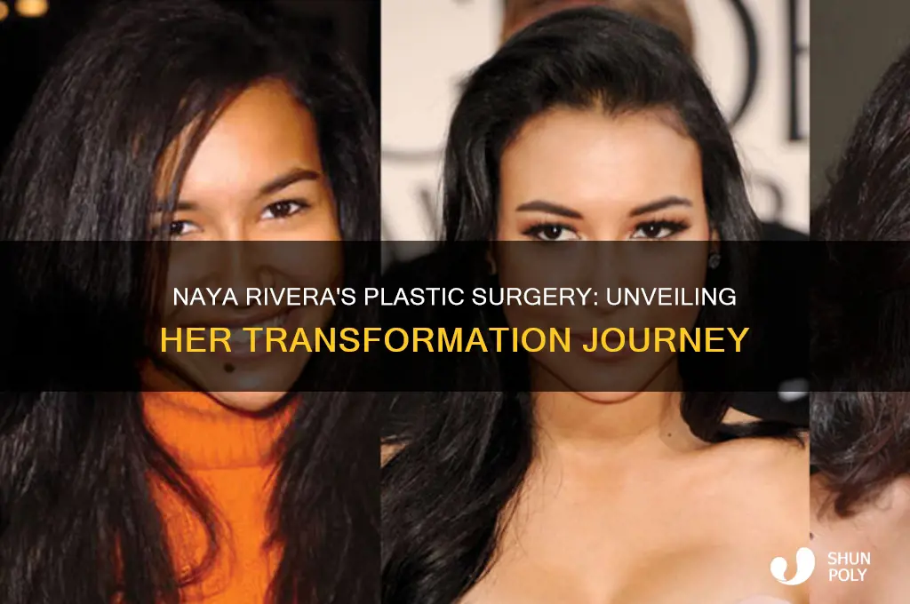 what plastic surgery did naya rivera have