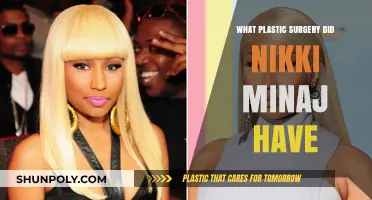 Unveiling Nikki Minaj's Plastic Surgery Transformations: Rumors vs. Reality