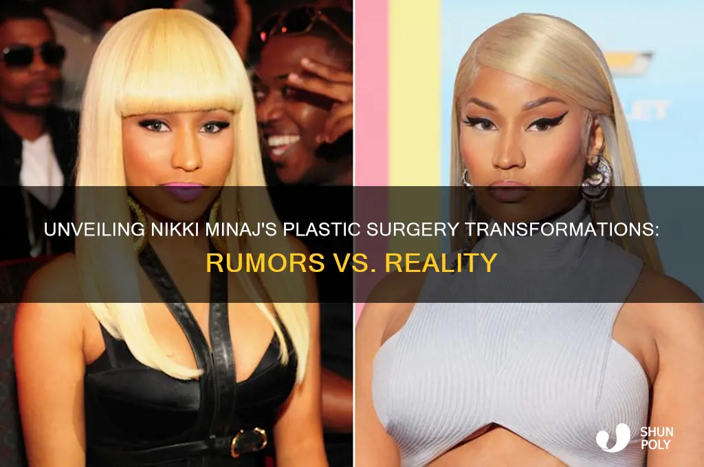 what plastic surgery did nikki minaj have