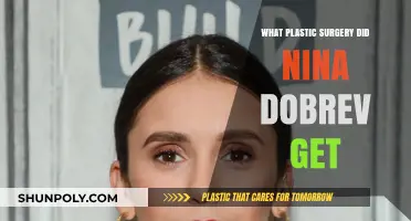 Nina Dobrev's Plastic Surgery: Fact-Checking Rumors and Speculations