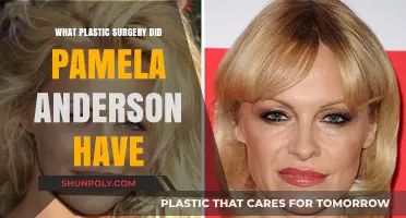 Pamela Anderson's Plastic Surgery Journey: Procedures and Transformations Revealed