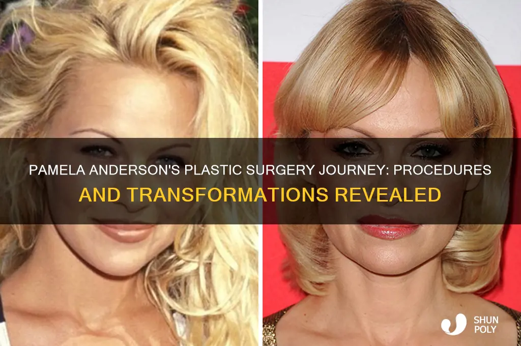 what plastic surgery did pamela anderson have