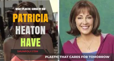 Patricia Heaton's Plastic Surgery: Procedures and Transformation Explained