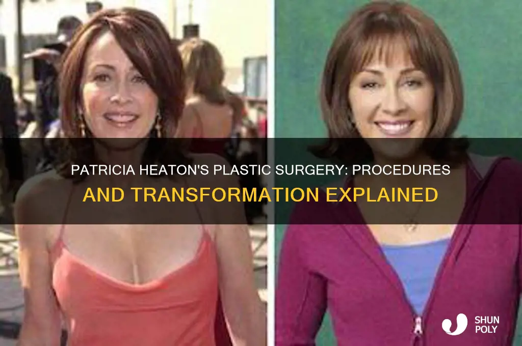 what plastic surgery did patricia heaton have