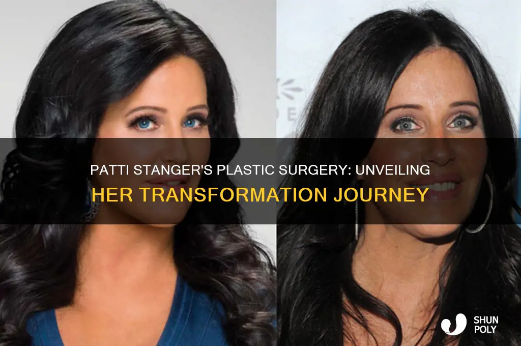 what plastic surgery did patti stanger have