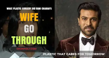 Ram Charan's Wife's Plastic Surgery Transformation: Speculations and Facts