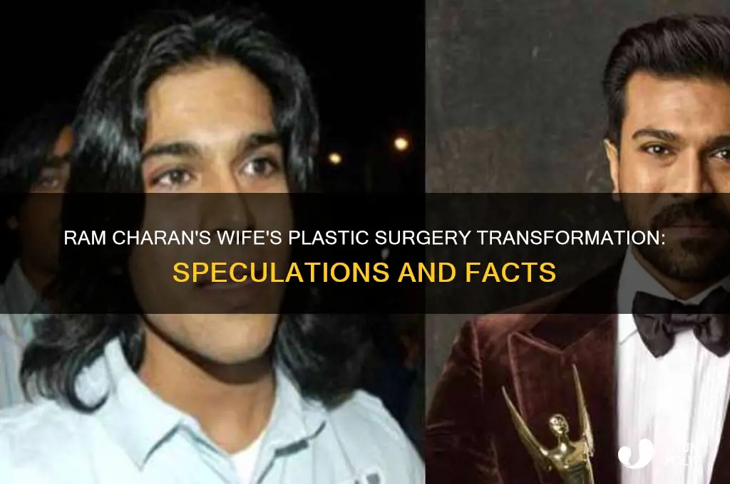 what plastic surgery did ram charan