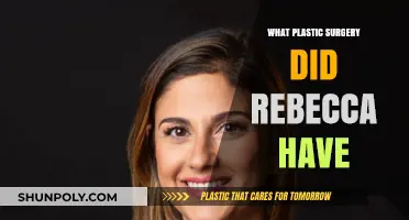 Rebecca's Plastic Surgery: Unveiling Her Transformation and Procedures