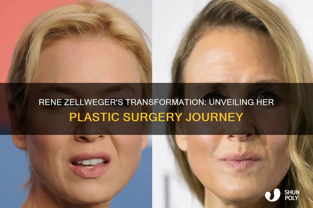 what plastic surgery did rene zellweger have done