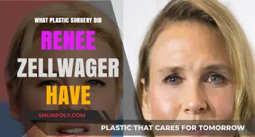 Renee Zellweger's Plastic Surgery: Unveiling the Truth Behind Her Transformation